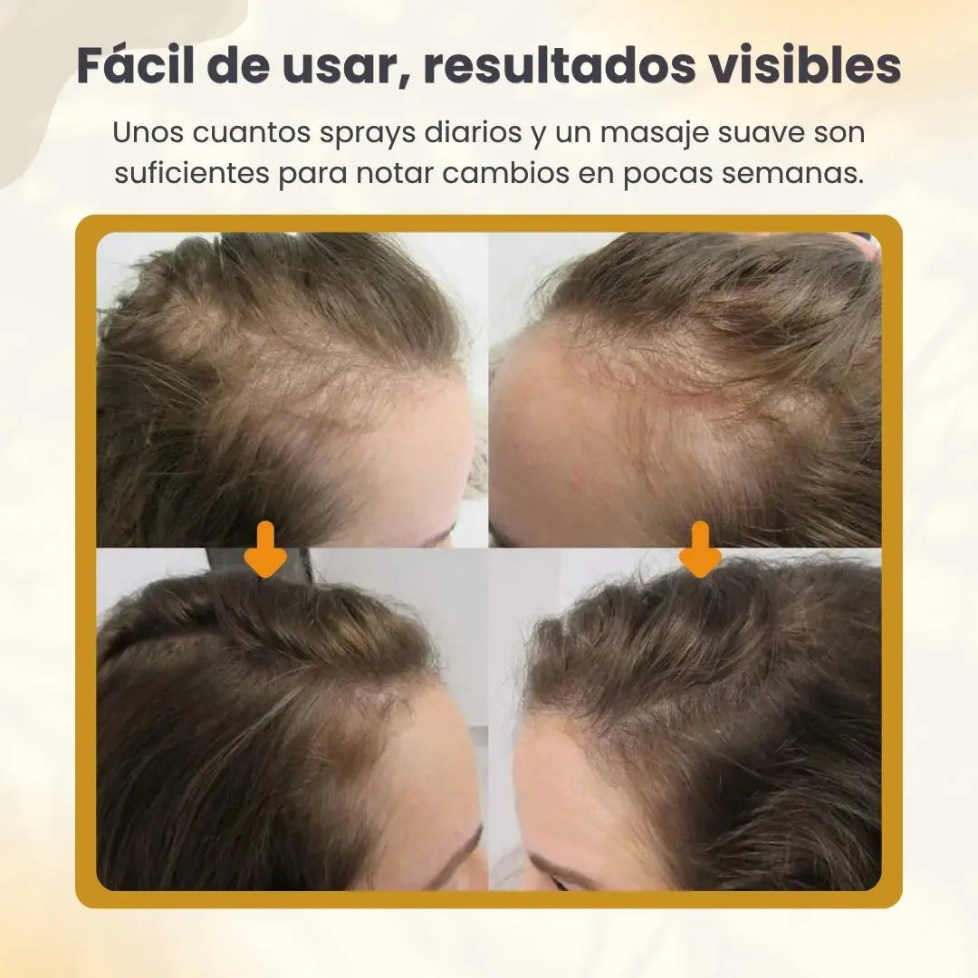 Biotin Premium-crecimiento acelerado de cabello ShopMundo